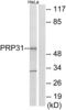 Pre-MRNA Processing Factor 31 antibody, LS-C119175, Lifespan Biosciences, Western Blot image 
