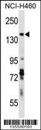 Diaphanous Related Formin 3 antibody, 58-585, ProSci, Western Blot image 