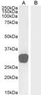 TGFB Induced Factor Homeobox 2 antibody, 46-484, ProSci, Western Blot image 