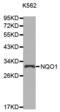 DT-diaphorase antibody, abx000532, Abbexa, Western Blot image 