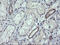 Ring Finger Protein 39 antibody, M14109, Boster Biological Technology, Immunohistochemistry paraffin image 