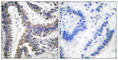 DNA Fragmentation Factor Subunit Alpha antibody, abx015539, Abbexa, Western Blot image 