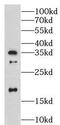Lymphocyte antigen 96 antibody, FNab04900, FineTest, Western Blot image 