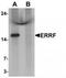 Steroid Receptor Associated And Regulated Protein antibody, TA320116, Origene, Western Blot image 