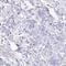 4-Hydroxyphenylpyruvate Dioxygenase antibody, NBP2-32657, Novus Biologicals, Immunohistochemistry frozen image 