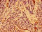 Chromosome 19 Open Reading Frame 12 antibody, orb401152, Biorbyt, Immunohistochemistry paraffin image 