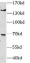 Zinc Finger And BTB Domain Containing 11 antibody, FNab09588, FineTest, Western Blot image 