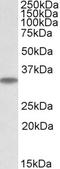 Microtubule-associated protein RP/EB family member 3 antibody, EB09828, Everest Biotech, Western Blot image 