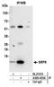 Signal Recognition Particle 9 antibody, A305-455A, Bethyl Labs, Immunoprecipitation image 