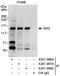 ABL Proto-Oncogene 2, Non-Receptor Tyrosine Kinase antibody, A301-988A, Bethyl Labs, Immunoprecipitation image 