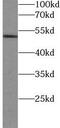 Glycogen Synthase Kinase 3 Beta antibody, FNab10504, FineTest, Western Blot image 