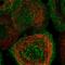 Metabolism Of Cobalamin Associated C antibody, PA5-55597, Invitrogen Antibodies, Immunofluorescence image 