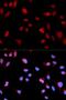 ABL Proto-Oncogene 1, Non-Receptor Tyrosine Kinase antibody, MBS125425, MyBioSource, Immunofluorescence image 