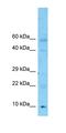 SH3 Domain Binding Glutamate Rich Protein Like 3 antibody, orb327407, Biorbyt, Western Blot image 