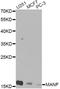 Mesencephalic Astrocyte Derived Neurotrophic Factor antibody, A7005, ABclonal Technology, Western Blot image 
