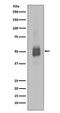 LYN Proto-Oncogene, Src Family Tyrosine Kinase antibody, P01424-1, Boster Biological Technology, Western Blot image 