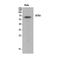 Netrin 1 antibody, STJ96887, St John
