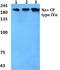 Sodium channel protein type 4 subunit alpha antibody, A01138-1, Boster Biological Technology, Western Blot image 