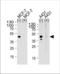 Calcitonin Receptor antibody, TA324814, Origene, Western Blot image 