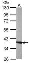 Twinfilin Actin Binding Protein 1 antibody, GTX111439, GeneTex, Western Blot image 