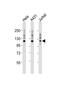 Integrin alpha-7 antibody, PA5-49447, Invitrogen Antibodies, Western Blot image 