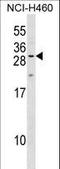 Myelin Protein Zero Like 2 antibody, LS-C158292, Lifespan Biosciences, Western Blot image 