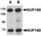 Nuclear pore complex protein Nup160 antibody, MBS150987, MyBioSource, Western Blot image 