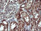 Prolactin-3D1 antibody, M05177-1, Boster Biological Technology, Immunohistochemistry paraffin image 