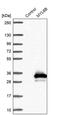 Myosin light chain 6B antibody, PA5-58579, Invitrogen Antibodies, Western Blot image 