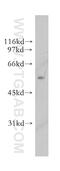 UDP-Glucose 6-Dehydrogenase antibody, 13151-1-AP, Proteintech Group, Western Blot image 