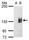mCherry Tag  antibody, NBP2-43769, Novus Biologicals, Western Blot image 