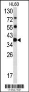 Methylosome subunit pICln antibody, 62-298, ProSci, Western Blot image 