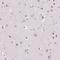 Nucleolar And Coiled-Body Phosphoprotein 1 antibody, HPA050388, Atlas Antibodies, Immunohistochemistry frozen image 