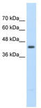 Beta-Ureidopropionase 1 antibody, TA344127, Origene, Western Blot image 