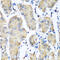 Pleckstrin antibody, 22-114, ProSci, Immunohistochemistry paraffin image 