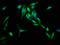 Ras and Rab interactor 1 antibody, LS-C671071, Lifespan Biosciences, Immunofluorescence image 