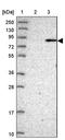 Bardet-Biedl Syndrome 7 antibody, PA5-60767, Invitrogen Antibodies, Western Blot image 
