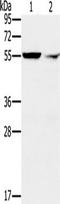 Protein Phosphatase, Mg2+/Mn2+ Dependent 1F antibody, TA351551, Origene, Western Blot image 