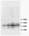 Growth Associated Protein 43 antibody, AM20622PU-N, Origene, Western Blot image 