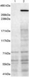Neurobeachin antibody, MBS420196, MyBioSource, Western Blot image 