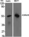 Cholinergic Receptor Nicotinic Alpha 10 Subunit antibody, PA5-50904, Invitrogen Antibodies, Western Blot image 