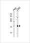 Dimethylarginine Dimethylaminohydrolase 2 antibody, orb330989, Biorbyt, Western Blot image 