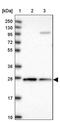 Cytochrome B5 Reductase 2 antibody, PA5-58611, Invitrogen Antibodies, Western Blot image 