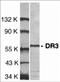 TNF Receptor Superfamily Member 25 antibody, 1158, ProSci Inc, Western Blot image 
