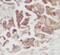 Keratin 14 antibody, FNab02197, FineTest, Immunohistochemistry paraffin image 