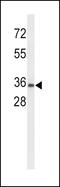 Uroplakin 1A antibody, LS-C160446, Lifespan Biosciences, Western Blot image 