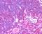 Unc-13 Homolog D antibody, PA5-18550, Invitrogen Antibodies, Immunohistochemistry paraffin image 