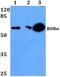 Nuclear receptor ROR-alpha antibody, GTX66669, GeneTex, Western Blot image 