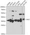 UDP-Galactose-4-Epimerase antibody, GTX33212, GeneTex, Western Blot image 