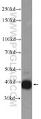 LDL Receptor Related Protein Associated Protein 1 antibody, 24662-1-AP, Proteintech Group, Western Blot image 